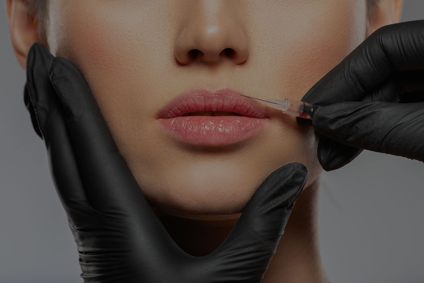 10 činjenica o dermalnim filerima za usnice